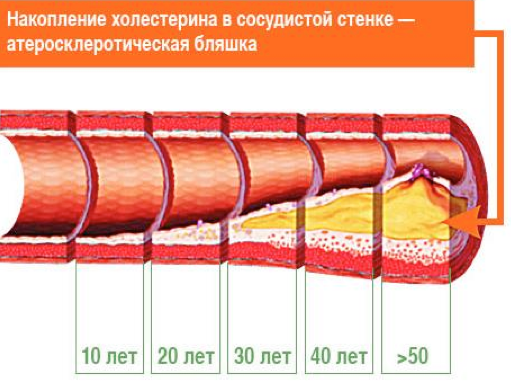 Влияние мышечной нагрузки на сердце и сосуды. Заболевания и гигиена сердечно-сосудистой системы - 1